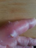 homöopathie im akutfall